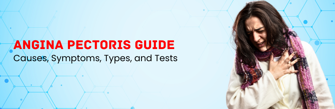 Angina Pectoris: Causes, Symptoms, Types, and Tests